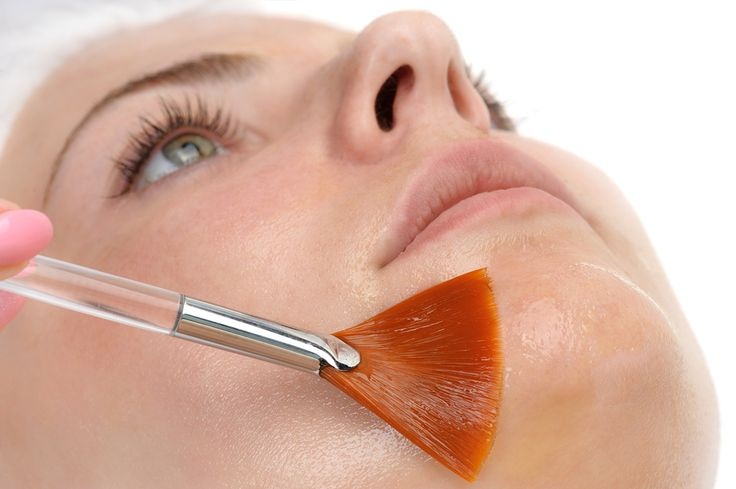 A Chemical Peel Brings New Life to Dead Skin