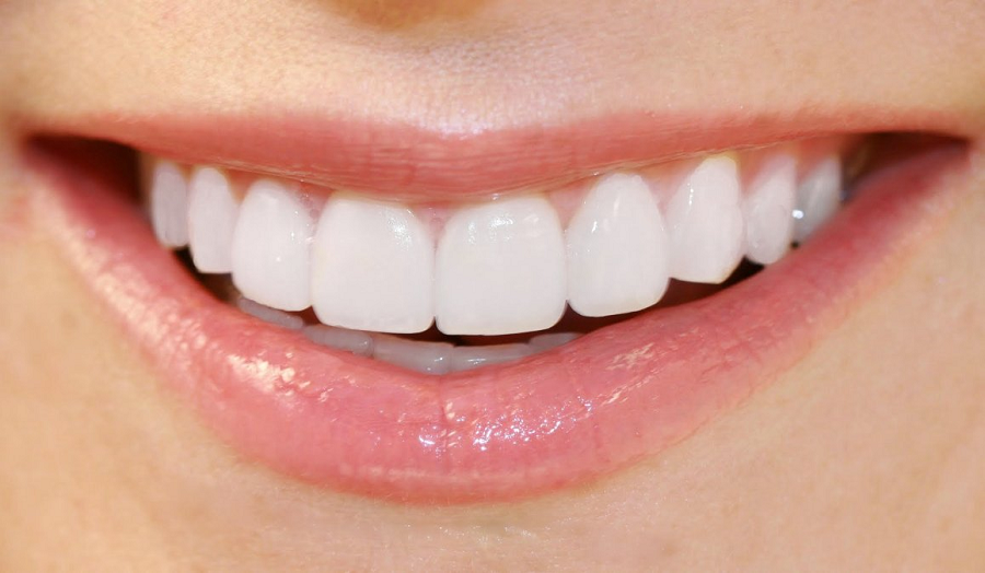 Find The Ultimate Teeth Whitening Hemel In Hempstead
